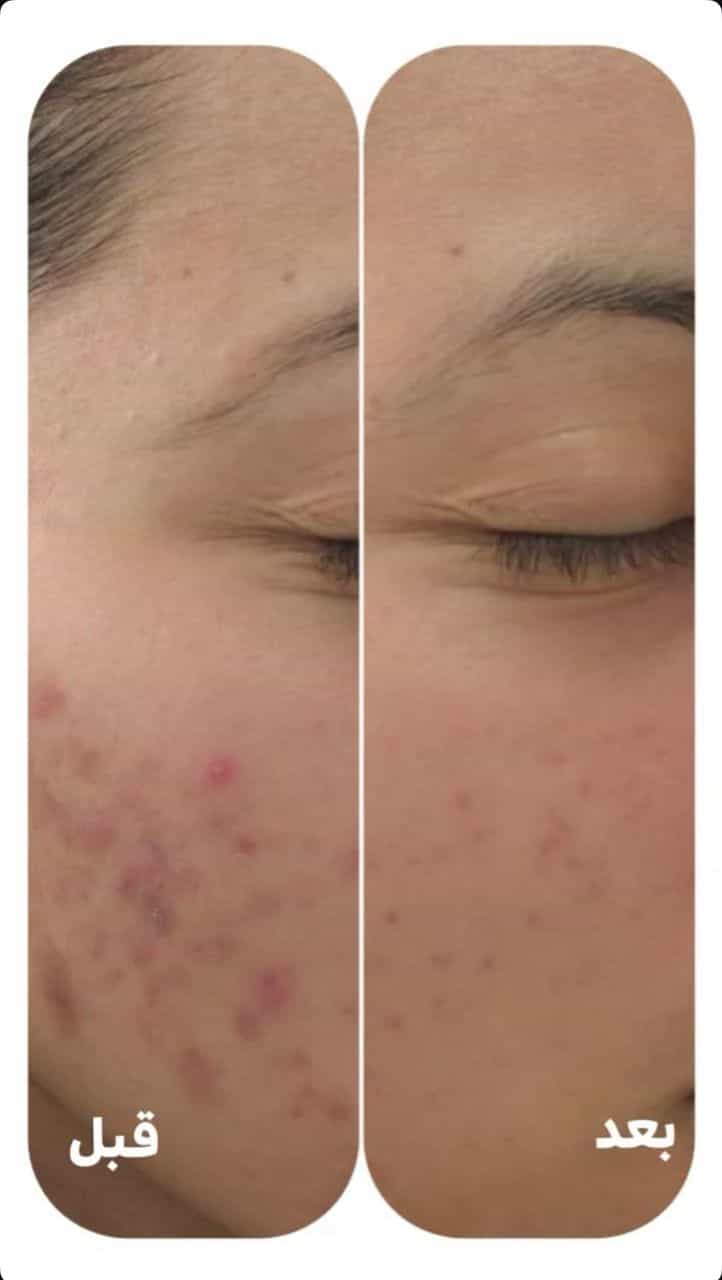 عکس خدمات فوق تخصصی پوست مژگان صالحی