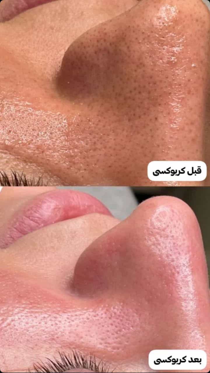 عکس خدمات فوق تخصصی پوست مژگان صالحی