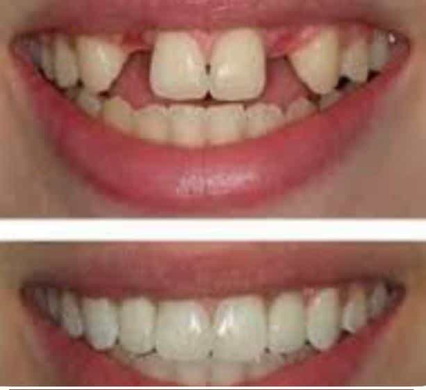 عکس دندان سازی ثامن کوی کمیته بجنورد