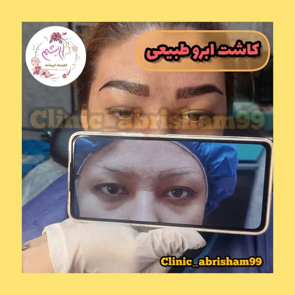 عکس کلینیک زیبایی کاشت مو و ابرو ابریشم در شهر قدس