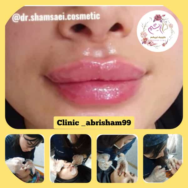 عکس کلینیک زیبایی کاشت مو و ابرو ابریشم در شهر قدس