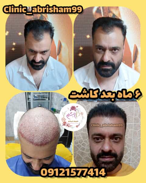 عکس کلینیک زیبایی کاشت مو و ابرو ابریشم در شهر قدس