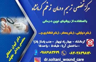 عکس زخم دیابتی لنف ادم لاغری و زیبایی دکتر کیوان سلطانی در کسری کرمانشاه