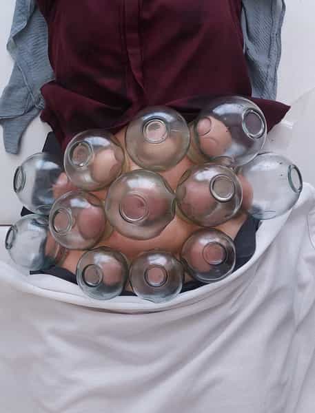 عکس کلینیک طب سنتی آرامش(ماساژوحجامت) در شریعتی کرمانشاه