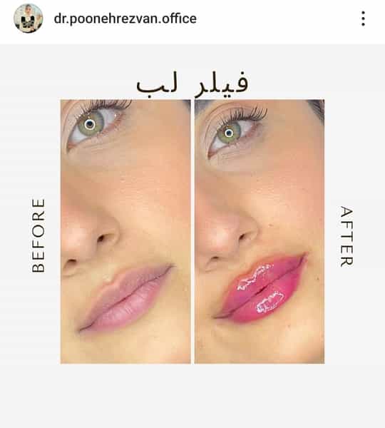 عکس مطب پوست زیبایی لیزر دکتر پونه رضوان در ولیعصر تبریز