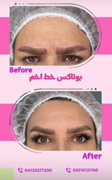 عکس کلینیک زیبایی دکتر مرضیه نیک نفس در ولیعصر تبریز