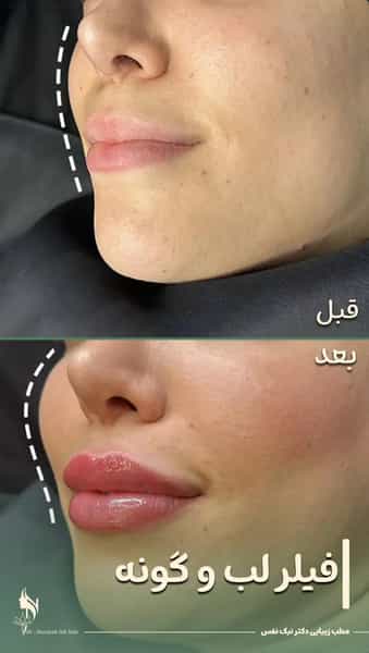 عکس کلینیک زیبایی دکتر مرضیه نیک نفس در ولیعصر تبریز