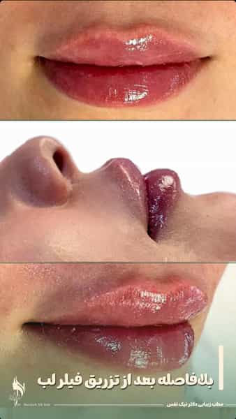 عکس کلینیک زیبایی دکتر مرضیه نیک نفس در ولیعصر تبریز