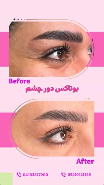 عکس کلینیک زیبایی دکتر مرضیه نیک نفس در ولیعصر تبریز