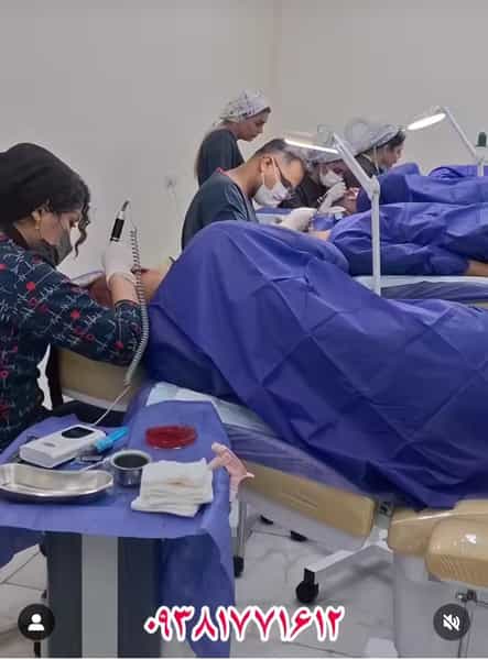 عکس کاشت مو کتکی در کیانپارس اهواز