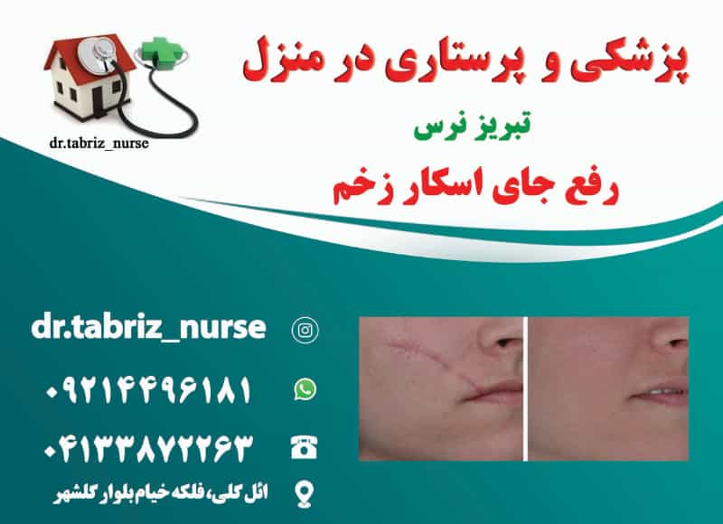 عکس مرکز ترمیم زخم بستر سوختگی پای دیابتیک تبریز نرس