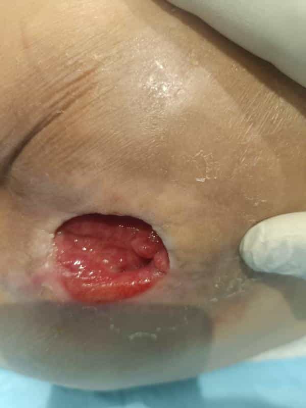 عکس مرکز ترمیم زخم بستر سوختگی پای دیابتیک تبریز نرس