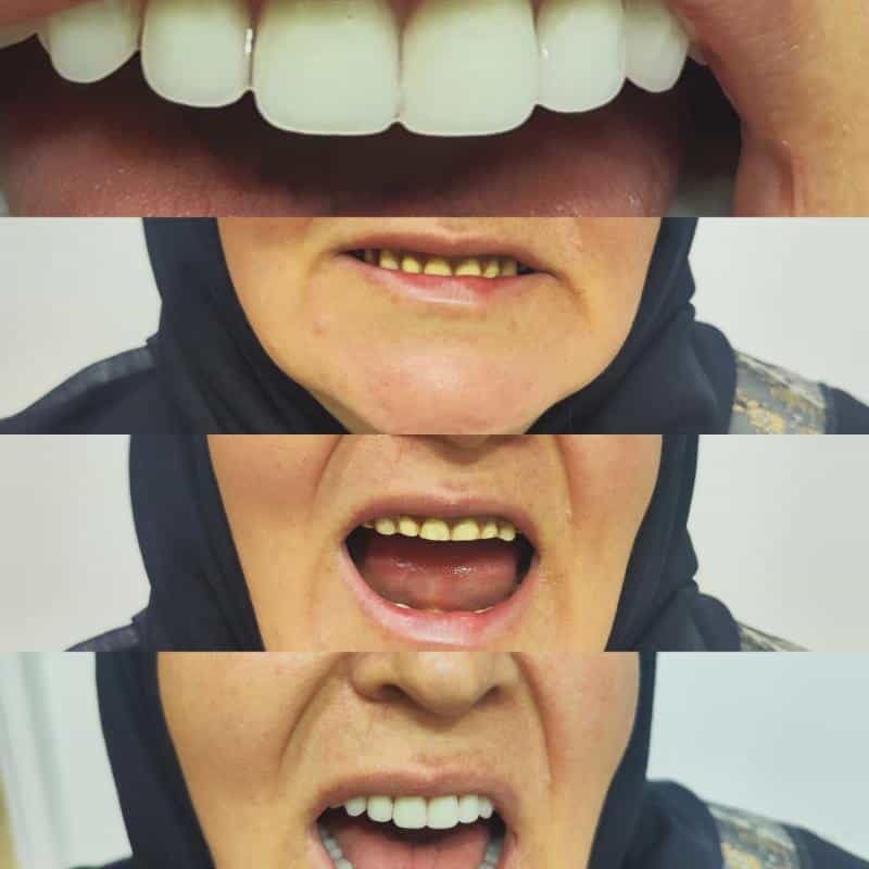 عکس دندانسازی حبیبی