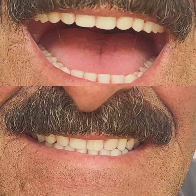 عکس دندانسازی حبیبی