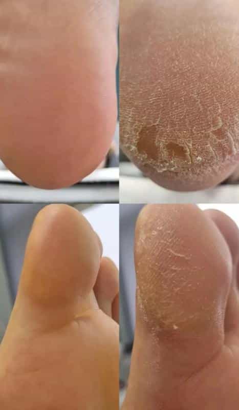 عکس کاشت ناخن مشهد