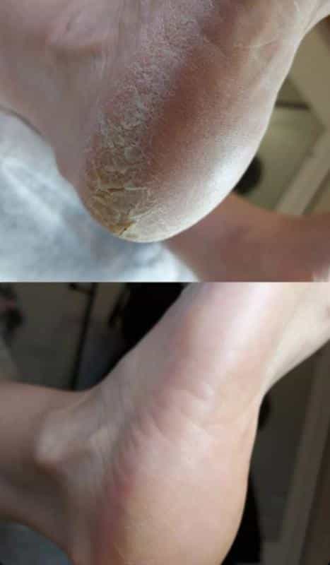 عکس کاشت ناخن مشهد