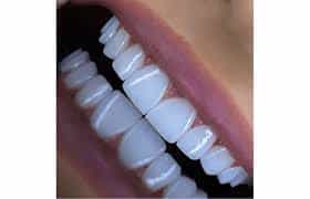 عکس مجموعه زیبایی و دندانپزشکی دیجیتال مروا در سعادت آباد