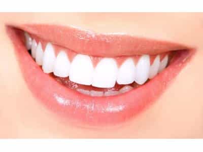 عکس دکتر مریم کریمیان جراح دندانپزشک بزرگسالان و کودکان در شریعتی