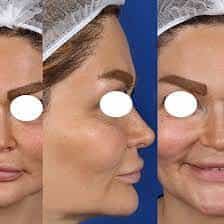 عکس  طب نگار مرکز فتوماکروگرافی و فتوگرافی پزشکی در کرج