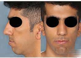 عکس  طب نگار مرکز فتوماکروگرافی و فتوگرافی پزشکی در کرج