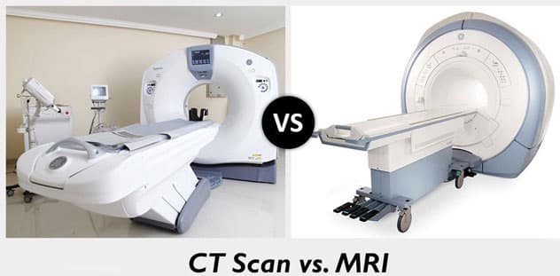 ام آی آر (MRI)