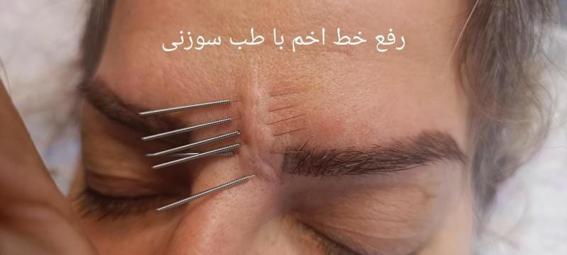 عکس مرکز طب سوزنی نارمک در تسلیحات