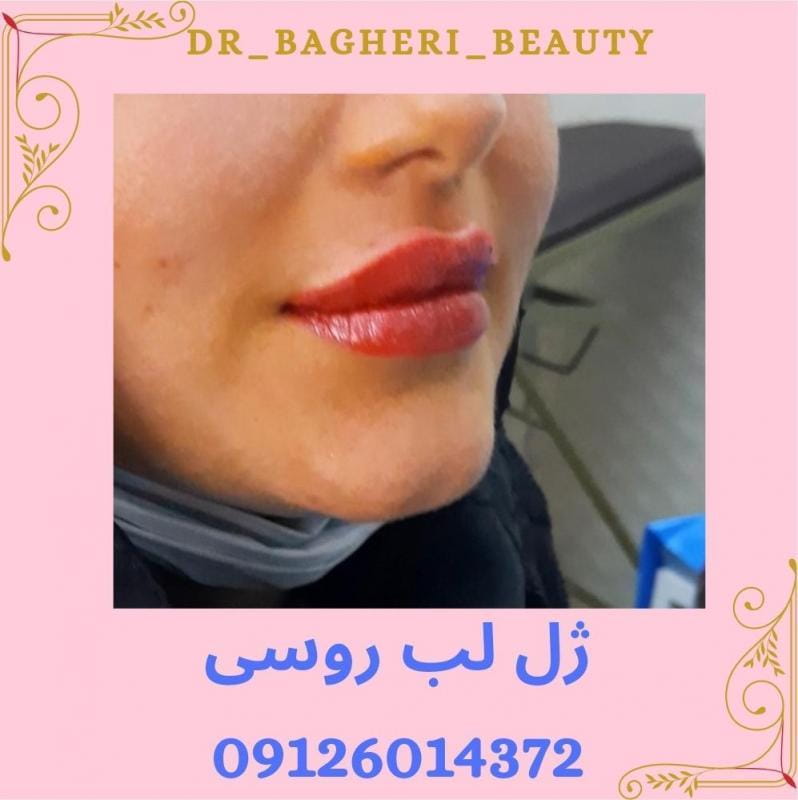 عکس مطب دکتر فاطمه آقاباقری، مرکز لیزر ژل بوتاکس در نبی اکرم