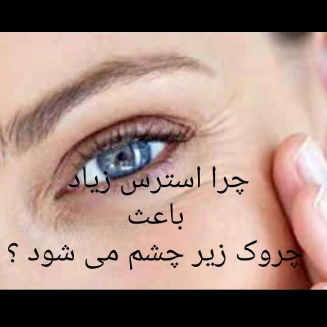 عکس عینک بینه در تهرانپارس غربی