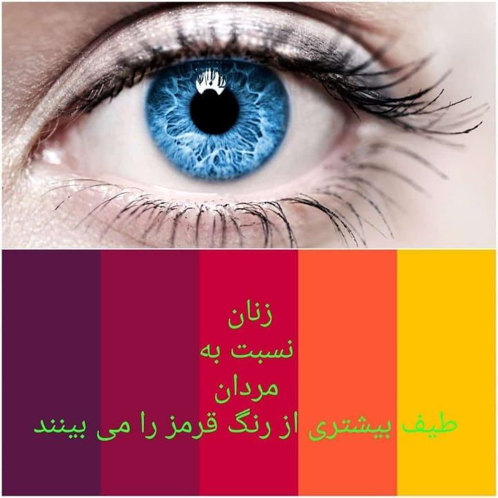 عکس عینک بینه در تهرانپارس غربی