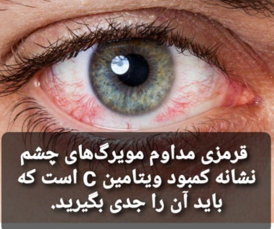 عکس عینک بینه در تهرانپارس غربی