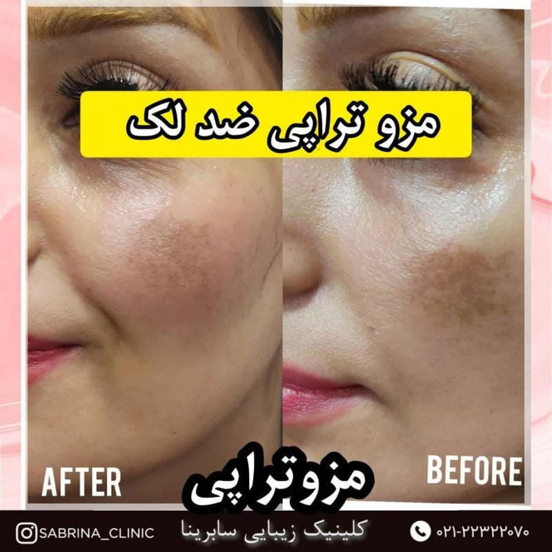 عکس کلینیک تخصصی لیزر ، هایفوتراپی و تزریق ژل و بوتاکس در مجیدیه