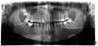 عکس دکتر شکیبایی رادیولوژی در سعادت آباد